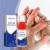 Ximonth Joint Care Spray, Gentle Care Nourishes Joints, Elbows And Knees Body Care Spray