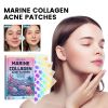 EELHOE Marine Collage Nacne Patches, Facial Acne Cleanser Multi-Shape Portable Acne Patch