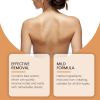Health & Personal Care,Skin care,Removing Wart and Nevi